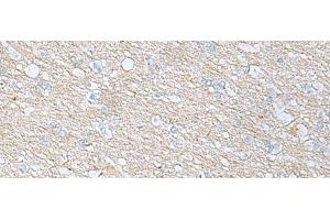 Immunohistochemistry of paraffin-embedded Human brain tissue using BDNF Polyclonal Antibody at dilution of 1:65(x200) (BDNF Antikörper)