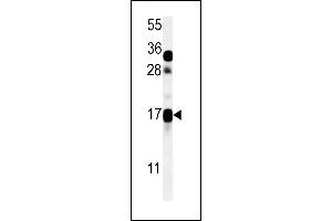 CSAG2 Antibody (N-term) (ABIN651616 and ABIN2840327) western blot analysis in ZR-75-1 cell line lysates (35 μg/lane). (CSAG2 Antikörper  (N-Term))