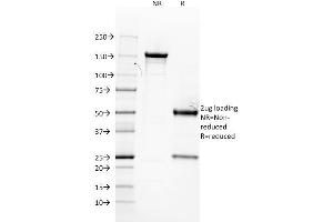 SDS-PAGE (SDS) image for anti-Estrogen Receptor 1 (ESR1) (AA 2-185) antibody (ABIN6939348)