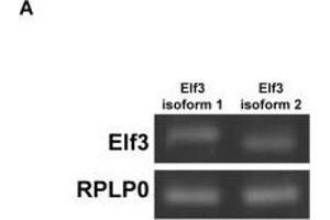 Elf3 overexpression enhanced basal and vasopressin-induced AQP2 promoter activity and transcription. (ELF3 Antikörper  (AA 1-280))