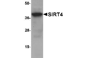 Western blot analysis of SIRT4 in human liver tissue lysate with SIRT4 antibody at 1 µg/mL.