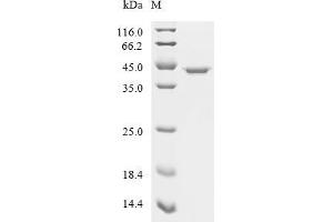 (Tris-Glycine gel) Discontinuous SDS-PAGE (reduced) with 5 % enrichment gel and 15 % separation gel.