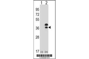 Western blot analysis of DLX5 using rabbit polyclonal DLX5 Antibody using 293 cell lysates (2 ug/lane) either nontransfected (Lane 1) or transiently transfected (Lane 2) with the DLX5 gene. (DLX5 Antikörper  (AA 100-128))