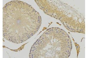 ABIN6279276 at 1/100 staining RAT testis tissue by IHC-P.