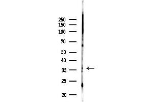 anti-Annexin A10 (ANXA10) (N-Term) antibody
