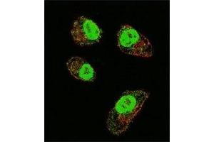 Immunofluorescence (IF) image for anti-Hypoxia Inducible Factor 1, alpha Subunit (Basic Helix-Loop-Helix Transcription Factor) (HIF1A) (AA 519-547) antibody (ABIN3031284)