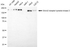 Western blotting analysis using erb-b2 receptor tyrosine kinase 2 antibody (ABIN7800157). (ErbB2/Her2 Antikörper)