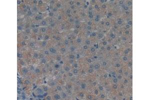 IHC-P analysis of liver tissue, with DAB staining. (TNKS2 Antikörper  (AA 959-1166))