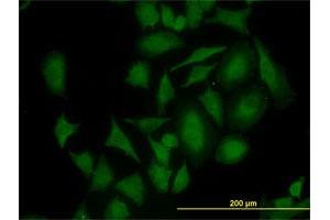 Immunofluorescence of monoclonal antibody to CDK4 on HeLa cell. (CDK4 Antikörper  (AA 211-303))
