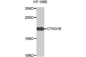 Western blot analysis of extracts of HT-1080 cells, using CTAG1B antibody. (CTAG1B Antikörper)