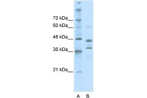 WB Suggested Anti-SMARCB1 Antibody Titration: 0. (SMARCB1 Antikörper  (Middle Region))