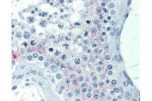 IHC-P Image Immunohistochemical analysis of paraffin-embedded human testis, using EDG7, antibody(20 μg/ml). (LPAR3 Antikörper)