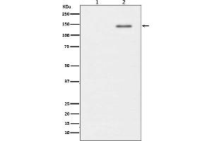 Western blot analysis of Phospho-SHIP  expression in (1) Raji cell lysate, (2) Raji cell treated with pervanadate lysate.