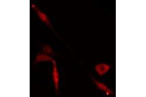 ABIN6274929 staining  Hela cells by IF/ICC. (BAZ2A Antikörper  (N-Term))