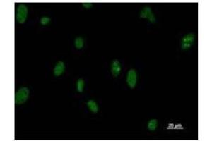 Immunostaining analysis in HeLa cells. (DDX5 Antikörper)