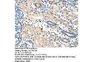 Rabbit Anti-PRMT5 Antibody  Paraffin Embedded Tissue: Human Kidney Cellular Data: Epithelial cells of renal tubule Antibody Concentration: 4. (PRMT5 Antikörper  (N-Term))