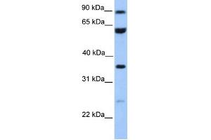 WB Suggested Anti-CCDC7 Antibody Titration: 0. (CCDC7 Antikörper  (N-Term))