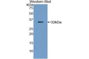 Western blot analysis of the recombinant protein. (FLNB Antikörper  (AA 1175-1457))