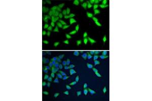 Immunofluorescence analysis of A-549 cells using WDR77 antibody (ABIN6128227, ABIN6150205, ABIN6150206 and ABIN6222948). (WDR77 Antikörper  (AA 1-260))