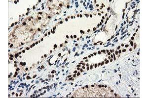 Immunohistochemical staining of paraffin-embedded Human Kidney tissue using anti-NMNAT1 mouse monoclonal antibody.
