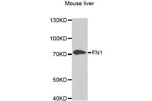 Western blot analysis of extracts of mouse liver, using FN1 antibody.