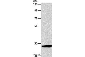 Western blot analysis of Mouse kidney tissue, using NCR1 Polyclonal Antibody at dilution of 1:450 (NCR1 Antikörper)