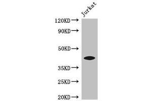 Western Blot Positive WB detected in: Jurkat whole cell lysate All lanes: FOXQ1 antibody at 3 μg/mL Secondary Goat polyclonal to rabbit IgG at 1/50000 dilution Predicted band size: 42 kDa Observed band size: 42 kDa (FOXQ1 Antikörper  (AA 10-123))