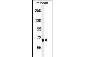 ACVR1B Antibody (ABIN659054 and ABIN2838060) western blot analysis in mouse heart tissue lysates (35 μg/lane).