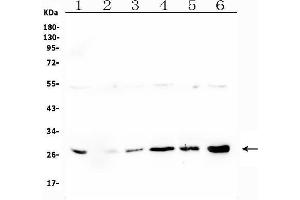 Western blot analysis of LRTOMT using anti-LRTOMT antibody (ABIN7602986). (Leucine Rich Transmembrane and 0-Methyltransferase Domain Containing (LRTOMT) (Middle Region) Antikörper)