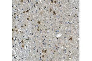 IHC analysis of PAR4/Pawr using anti-PAR4/Pawr antibody (ABIN7599938). (PAWR Antikörper  (AA 13-333))