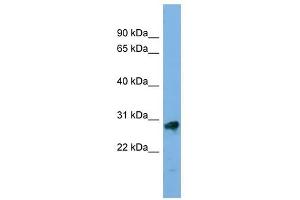 KLK13 antibody used at 1 ug/ml to detect target protein.