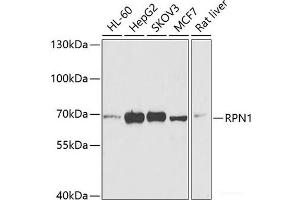 Western blot analysis of extracts of various cell lines using RPN1 Polyclonal Antibody at dilution of 1:1000. (RPN1 Antikörper)