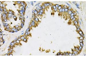Immunohistochemistry of paraffin-embedded Human prostate using EFNA1 Polyclonal Antibody at dilution of 1:100 (40x lens). (Ephrin A1 Antikörper)