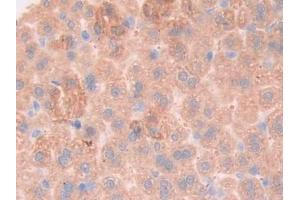 Detection of gp130 in Mouse Liver Tissue using Polyclonal Antibody to Glycoprotein 130 (gp130) (CD130/gp130 Antikörper  (AA 238-500))