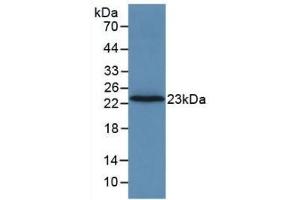 Detection of Recombinant F2, Rat using Monoclonal Antibody to Coagulation Factor II (F2) (Prothrombin Antikörper  (AA 44-200))