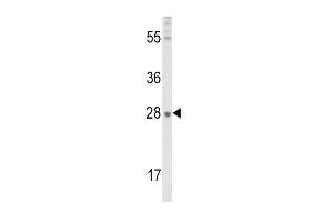 FGF10 Antikörper  (C-Term)