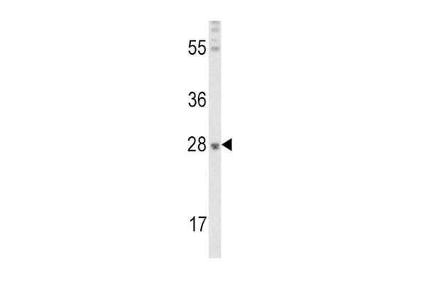 FGF10 Antikörper  (C-Term)