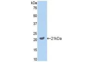 Detection of Recombinant GAS6, Mouse using Polyclonal Antibody to Growth Arrest Specific Protein 6 (GAS6) (GAS6 Antikörper  (AA 483-646))