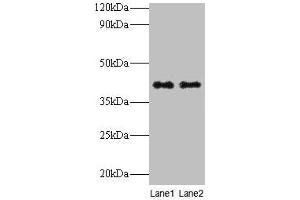 Western blot All lanes: QPCT antibody at 2 μg/mL Lane 1: Rat muscle tissue Lane 2: Rat adrenal gland tissue Secondary Goat polyclonal to rabbit IgG at 1/10000 dilution Predicted band size: 41, 36 kDa Observed band size: 41 kDa (QPCT Antikörper  (AA 29-361))