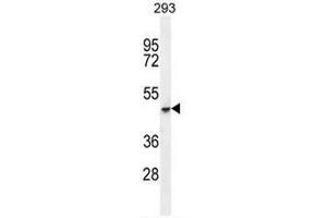 COCH Antibody (C-term) western blot analysis in 293 cell line lysates (35µg/lane).