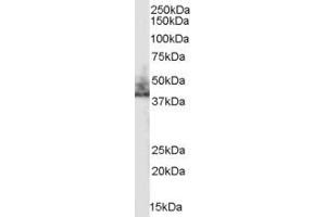 Western Blotting (WB) image for anti-Solute Carrier Family 9 (Sodium/hydrogen Exchanger), Member 3 Regulator 2 (SLC9A3R2) (Internal Region) antibody (ABIN185496)