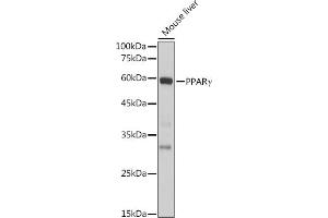 Western blot analysis of extracts of Mouse liver, using PPARγ antibody (ABIN6134090, ABIN6146004, ABIN6146006 and ABIN6215096) at 1:1000 dilution.