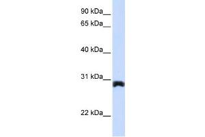 WB Suggested Anti-PEX11A Antibody Titration:  0. (PEX11A Antikörper  (Middle Region))