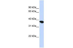 ST8SIA4 antibody used at 1 ug/ml to detect target protein. (ST8SIA4 Antikörper  (Middle Region))