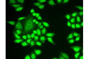 Immunofluorescence analysis of MCF-7 cell using RNF40 antibody. (RNF40 Antikörper)