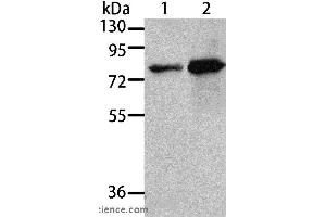Western blot analysis of 293T and A431 cell, using MSN Polyclonal Antibody at dilution of 1:500 (Moesin Antikörper)