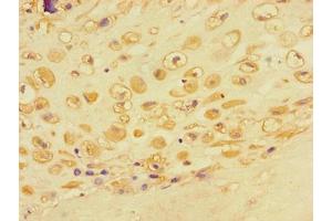 Immunohistochemistry of paraffin-embedded human placental tissue using ABIN7143102 at dilution of 1:100 (ACTR3 Antikörper  (AA 352-409))