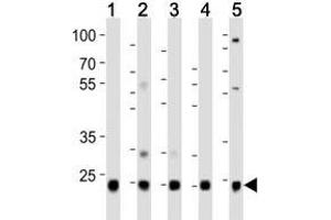Western Blotting (WB) image for anti-Ubiquitin (Ub) (N-Term) antibody (ABIN3029416)