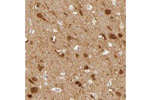 Immunohistochemical staining of human cerebral cortex with DLG3 polyclonal antibody  shows distinct nuclear and cytoplasmic positivity in neuronal cells at 1:50-1:200 dilution. (DLG3 Antikörper)