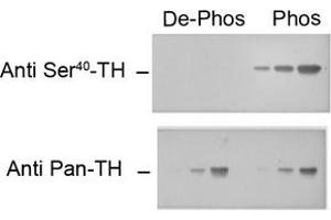 Image no. 1 for anti-Tyrosine Hydroxylase (TH) (pSer40) antibody (ABIN372738) (Tyrosine Hydroxylase Antikörper  (pSer40))